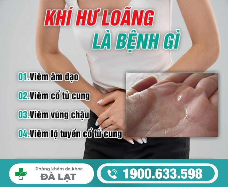 Hình ảnh minh họa